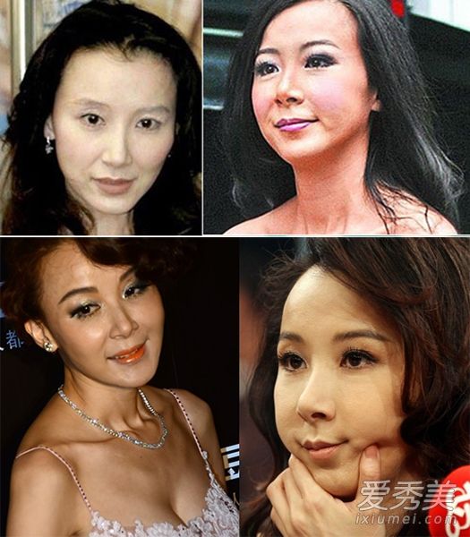 明星都在哪里整容，揭秘整容行業(yè)的熱門(mén)地點(diǎn)與趨勢(shì)，揭秘明星整容地點(diǎn)，行業(yè)熱門(mén)地點(diǎn)與趨勢(shì)探究