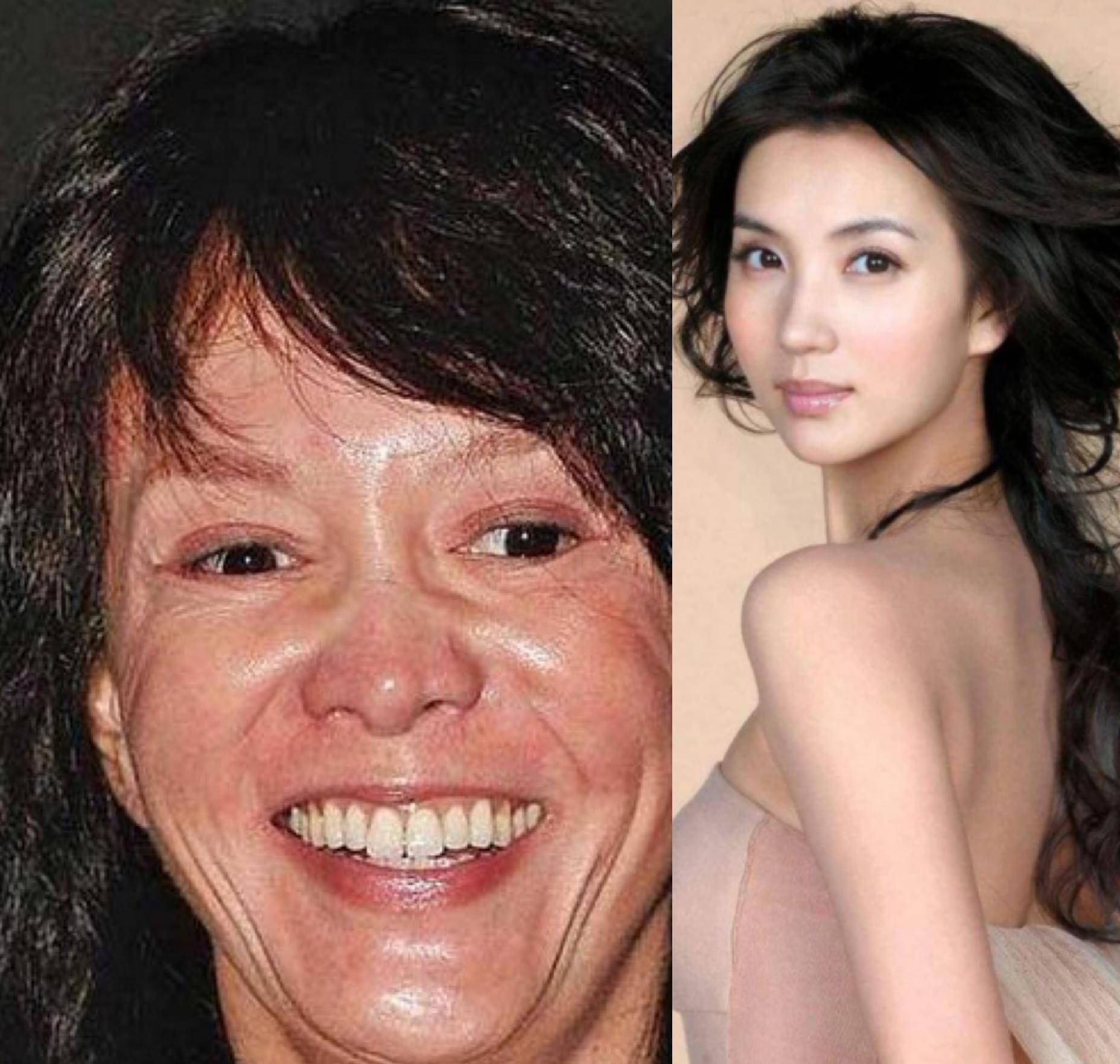 那些整容的明星，揭秘背后的故事，揭秘整容明星背后的故事