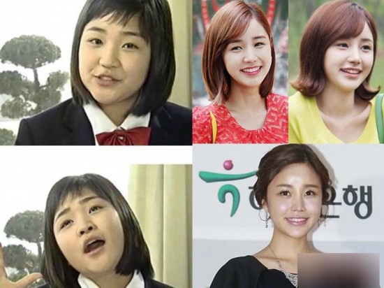整容女明星，美麗背后的故事與真相探索，整容女明星背后的故事與真相揭秘