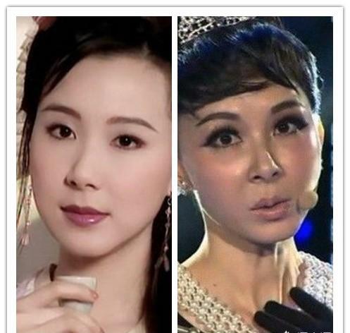 整容界的明星風(fēng)采，探究明星整容背后的故事，明星整容背后的故事，揭秘整容界中的璀璨風(fēng)采
