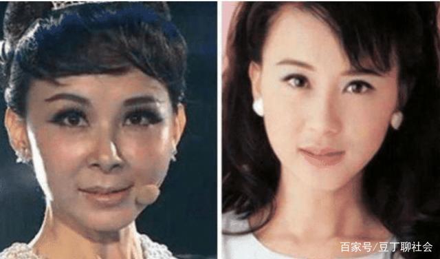 為啥明星整容那么自然？揭秘背后的秘密，揭秘明星整容自然背后的秘密原因