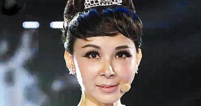 中國整容第一美人，美麗背后的故事與啟示，中國整容第一美人背后的故事與啟示，美麗背后的啟示