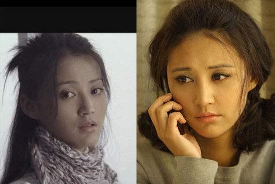 整容成功的案例，重塑美麗人生，整容重塑美麗人生，成功案例分享