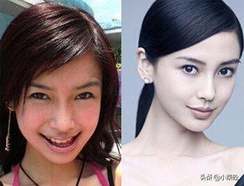 美女整容，探索美麗的新境界，美女整容，探尋美麗新境界的旅程