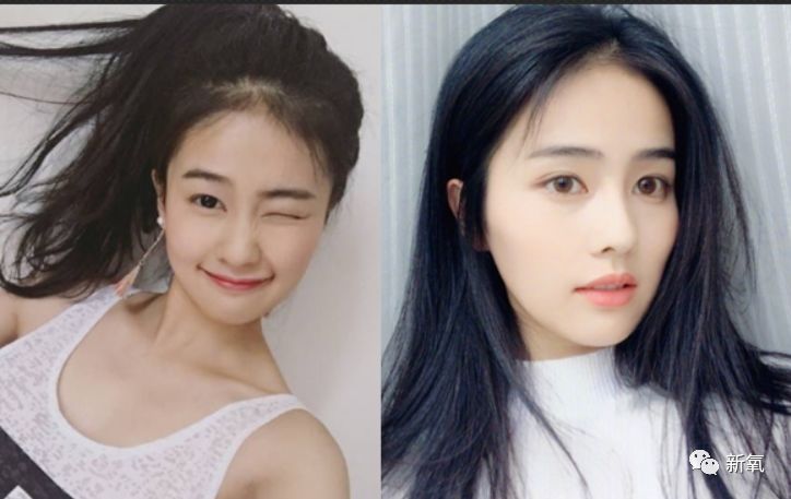 白鹿整容前后對比，深度解析與對比，白鹿整容前后深度對比與解析