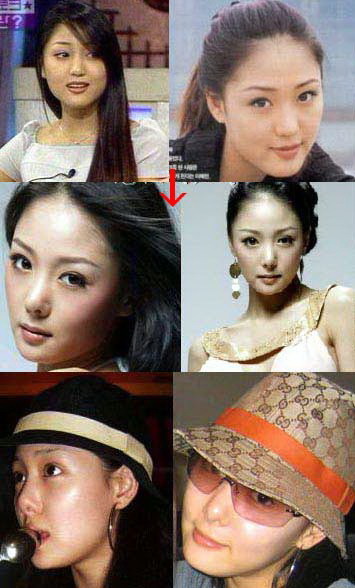 整容失敗的女明星
