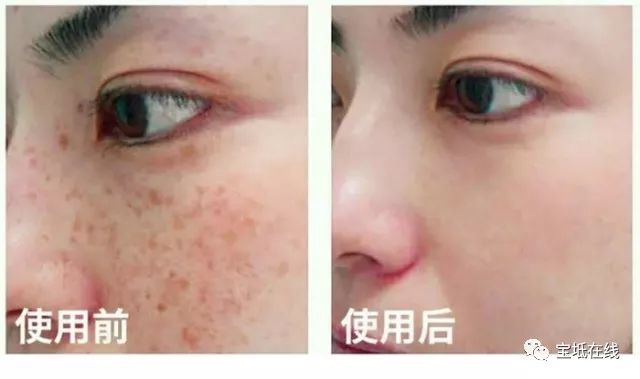 免費(fèi)祛斑的方法，自然美麗無需花費(fèi)高昂代價(jià)，自然祛斑秘籍，免費(fèi)打造美麗無瑕肌膚，無需高昂代價(jià)！