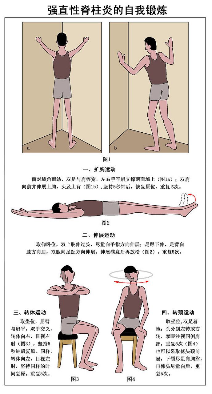 強直性脊柱炎早期自測指南，強直性脊柱炎早期自我檢測指南
